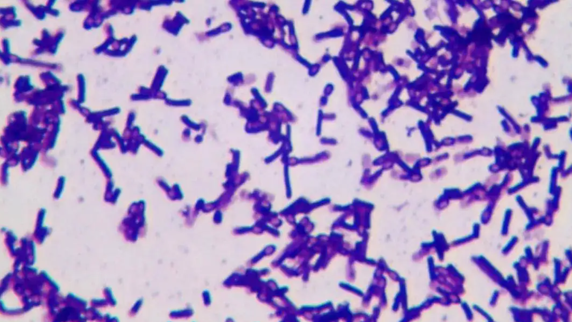 補充益生菌是否會有依賴性？