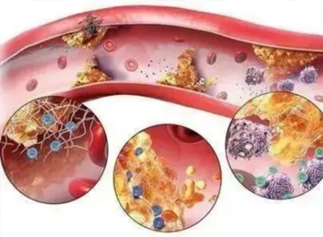 酵素,血管的清道夫!